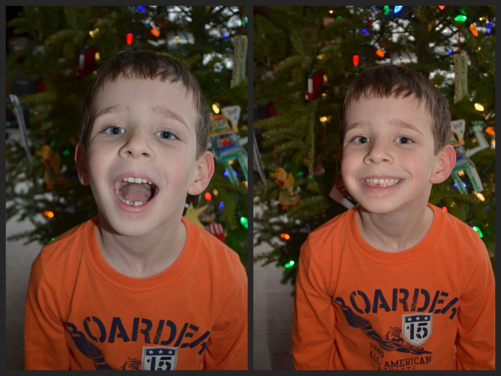 2014 - 12 December 12 - Lincoln loses 1st tooth